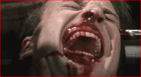 Relax, they're just drilling to let the demons out of your head...