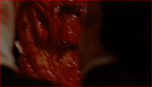 Top of the head:  way easier to skin than the front.