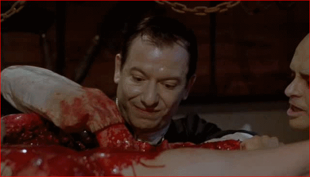 Hmm, gonna have to cut around all these weeping sores.