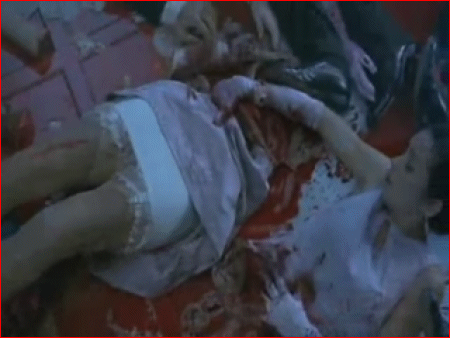 Debbie's lapband surgery goes horribly wrong!
