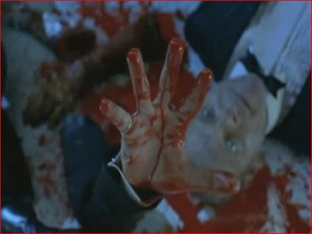 Raise your hand if you have a severed arm!