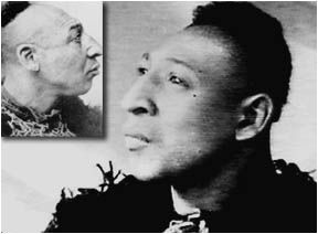 The dude that 'zippy the pinhead' was based on. Fo' real.