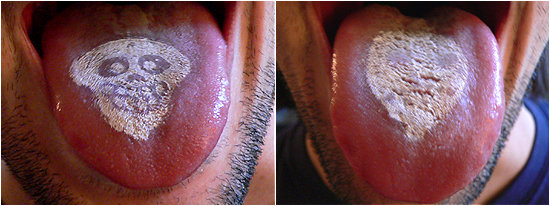 Stain-O-Licious!