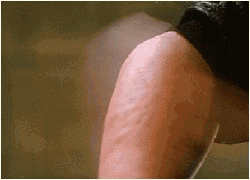 My ashy elbow!