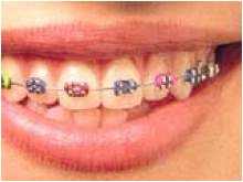 Ms. Metal Mouth