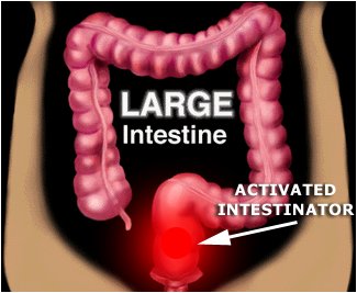 The Intestinator
